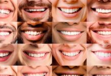 SORRISO SAUDÁVEL COMEÇA COM INFORMAÇÃO!