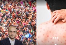 Primeiro caso de Mpox em 2026 acende alerta durante o Carnaval