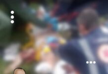 Ataque brutal: idosa tem braços e perna amputados após ataque de pitbulls; dono é preso