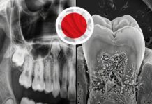 Cientistas desenvolvem medicamento que pode permitir o crescimento de novos dentes naturais